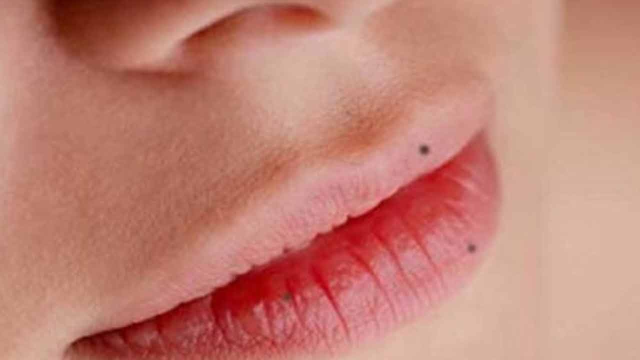 Mole | పుట్టుమచ్చలు మంచివేనా..? స్త్రీకి పుట్టుమచ్చ అక్కడుంటే ఎంతో అదృష్టమట..! Mole | పుట్టుమచ్చలు మంచివేనా..? స్త్రీకి పుట్టుమచ్చ అక్కడుంటే ఎంతో అదృష్టమట..!