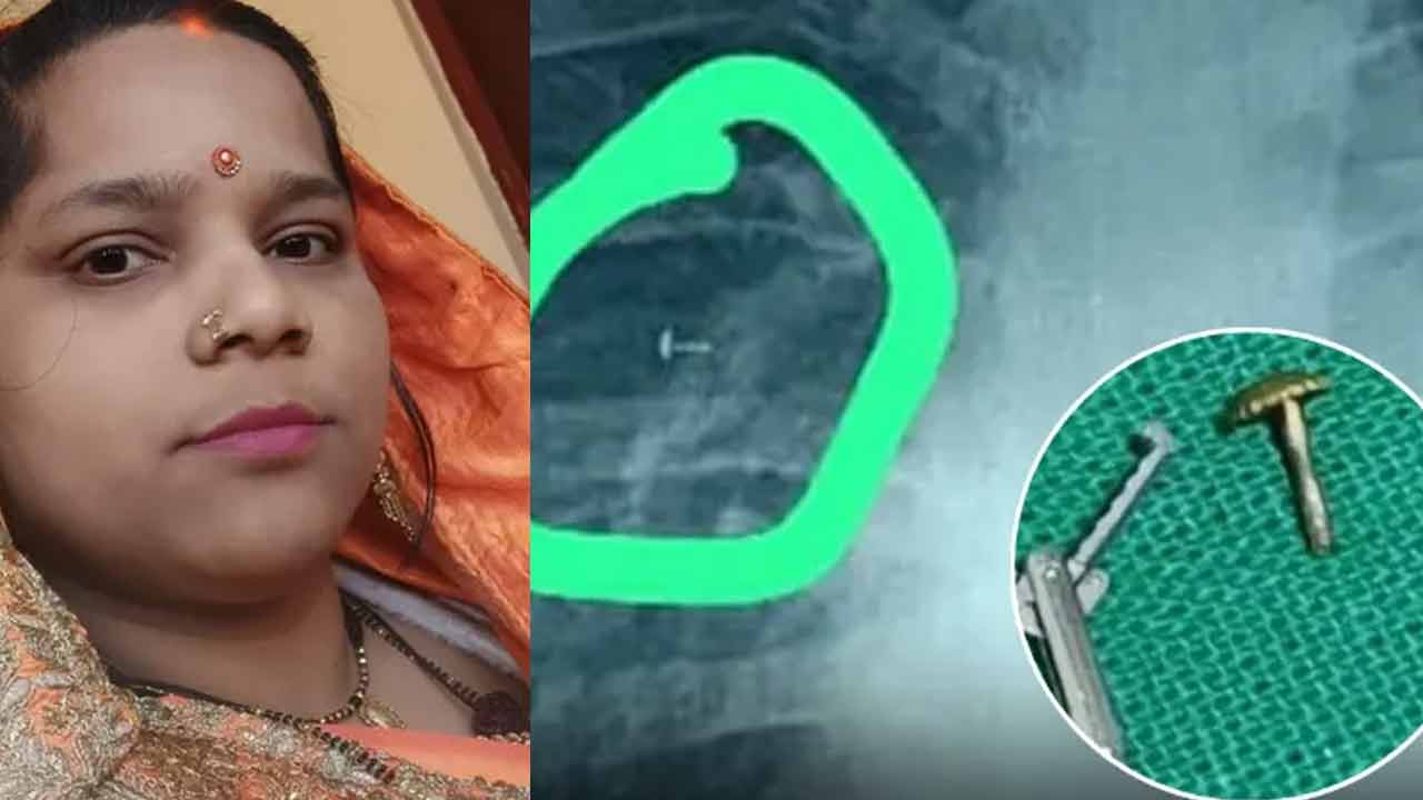 గట్టిగా గాలి పీల్చేసరికి.. ఊపిరితిత్తుల్లోకి వెళ్లిన ముక్కుపుల్ల.. గట్టిగా గాలి పీల్చేసరికి.. ఊపిరితిత్తుల్లోకి వెళ్లిన ముక్కుపుల్ల..