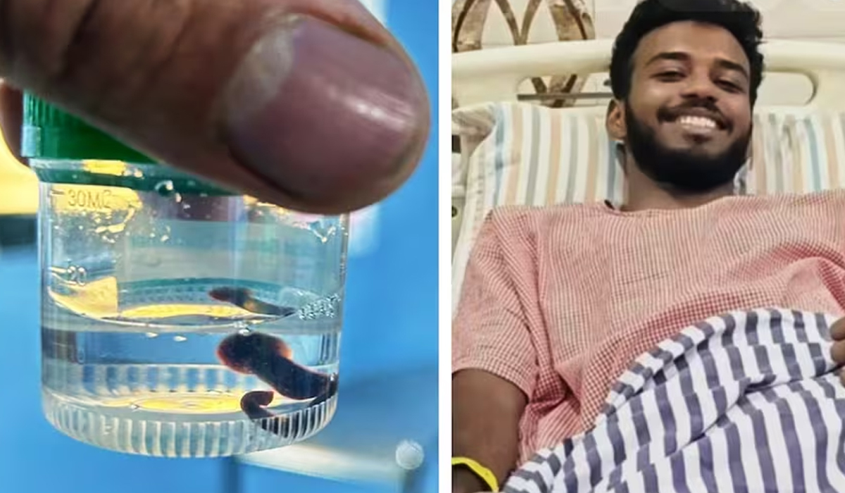 Leech In Nose | యువకుడిలో ముక్కులో జలగ..! వైద్యశాస్త్రంలో అరుదైన ఘటన..! Leech In Nose | యువకుడిలో ముక్కులో జలగ..! వైద్యశాస్త్రంలో అరుదైన ఘటన..!