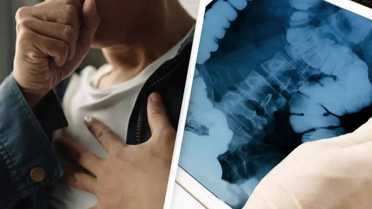 Intestines | బ్రేక్ ఫాస్ట్ చేస్తుండగా విపరీతమైన దగ్గు.. కడుపులో నుంచి బయటపడ్డ పెద్ద ప్రేగు Intestines | బ్రేక్ ఫాస్ట్ చేస్తుండగా విపరీతమైన దగ్గు.. కడుపులో నుంచి బయటపడ్డ పెద్ద ప్రేగు
