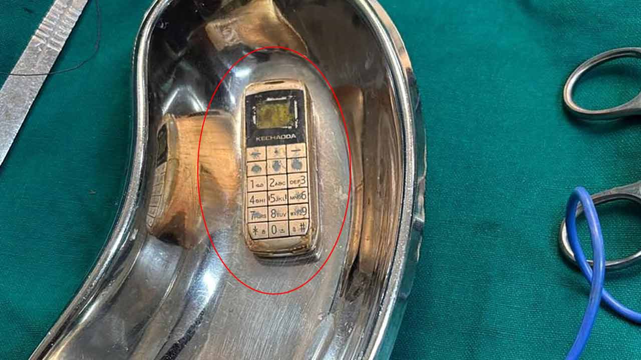 Prisoner swallow’s Mobile | జైల్లో మొబైల్ ఫోన్ను మింగిన ఖైదీ.. బయటపడిందిలా..! Prisoner swallow’s Mobile | జైల్లో మొబైల్ ఫోన్ను మింగిన ఖైదీ.. బయటపడిందిలా..!
