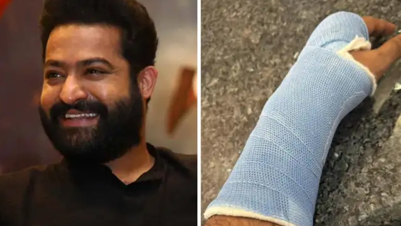 Jr NTR : జూనియర్ ఎన్టీఆర్ కు గాయాలు!