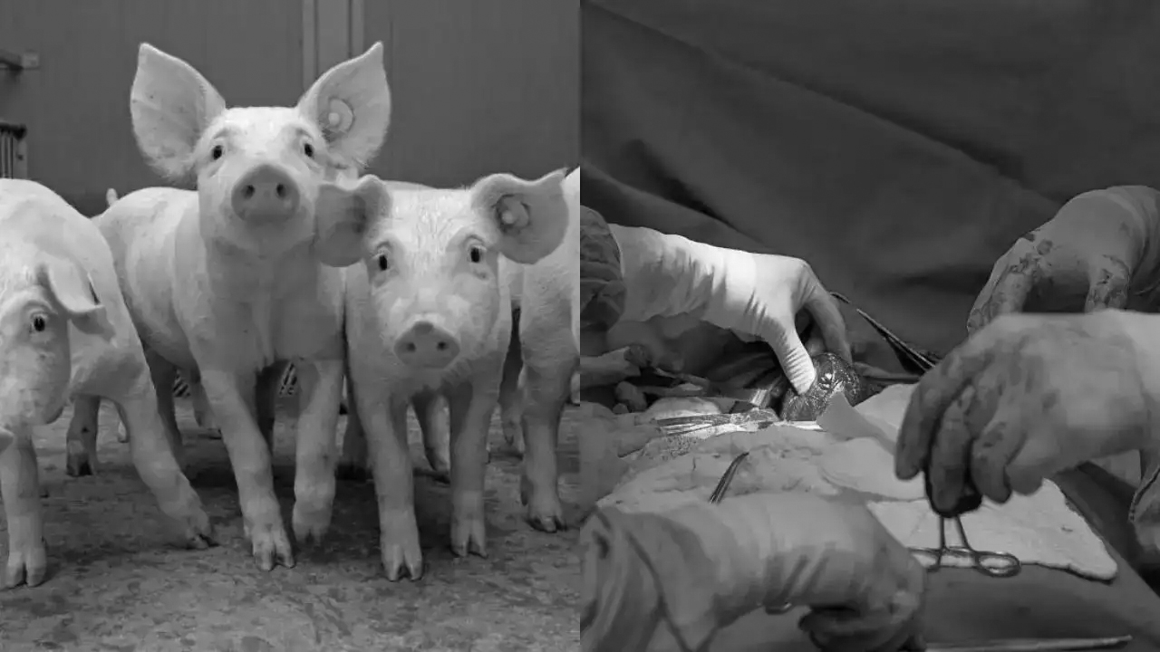 Pig To Human Liver Transplant | ప్రపంచంలో తొలి పంది కాలేయ మార్పిడి -171 రోజుల పాటు జీవించిన చైనా వ్యక్తి Pig To Human Liver Transplant | ప్రపంచంలో తొలి పంది కాలేయ మార్పిడి -171 రోజుల పాటు జీవించిన చైనా వ్యక్తి