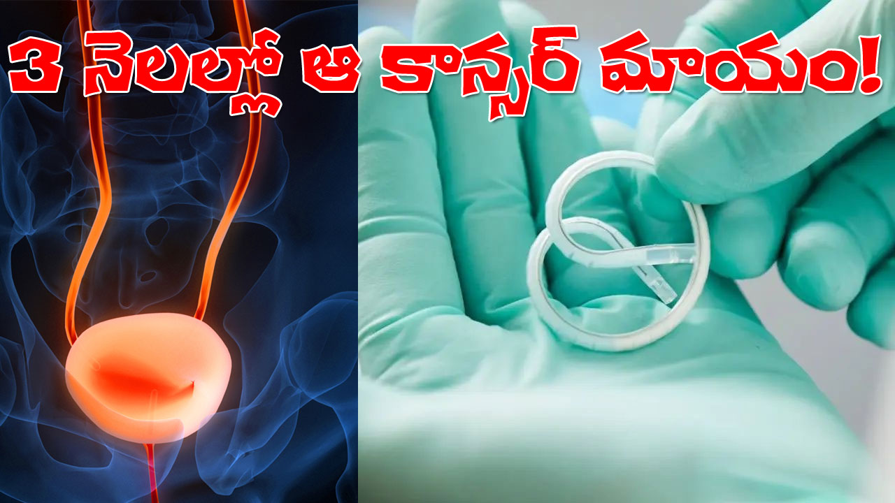 TAR-200 Gm-stuffed Pretzel reperasentational image