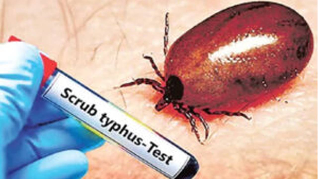 ఏపీలో స్క్రబ్ టైఫస్ పంజా..15 మందికి పైగా మృతి Scrub Typhus
