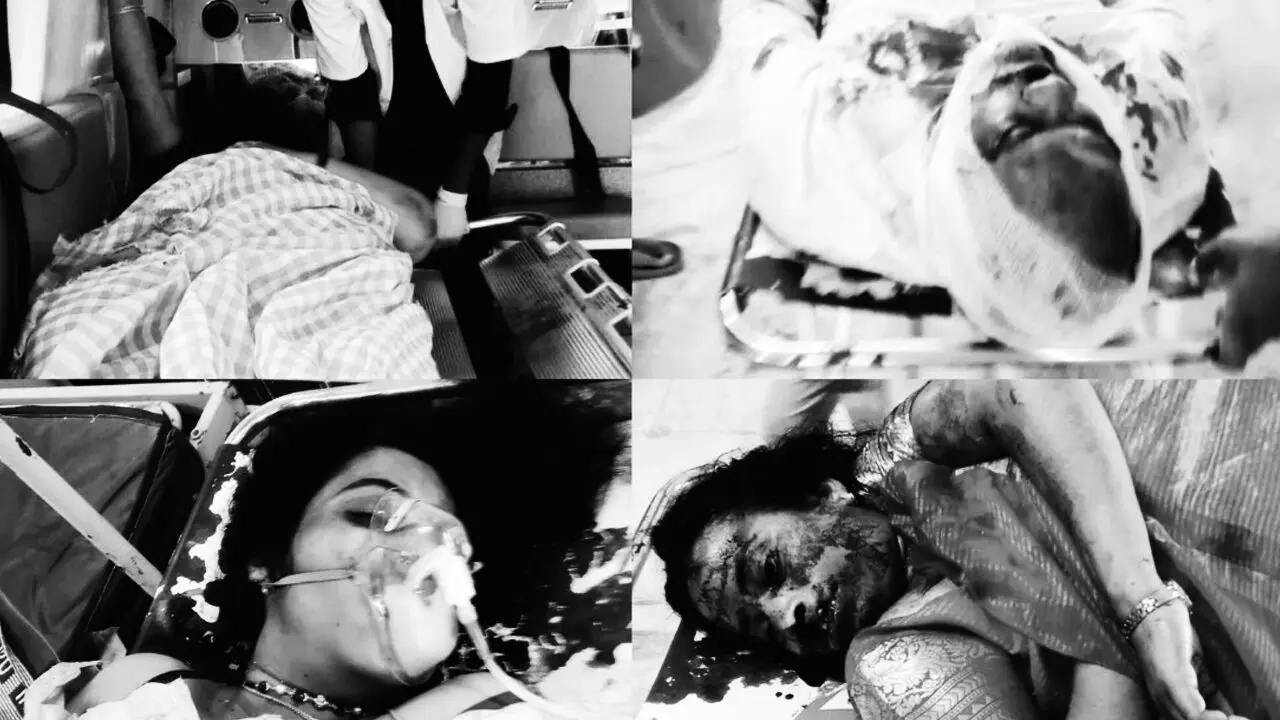 Road Accident : పాఠశాలకు వెలుతున్న కారు బోల్తా..ఇద్దరు టీచర్ల దుర్మరణం