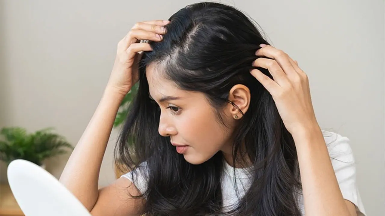 Dandruff Home Remedies : ఇంటి చిట్కాలతోనే చుండ్రుకు చెక్‌ పెట్టండి ఇలా..