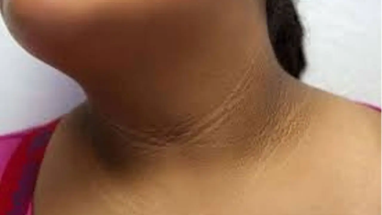 Black Neck | మెడ భాగం నల్లగా మారి ఇబ్బంది పెడుతోందా..? అయితే ఇంట్లోనే ఇలా ట్రై చేసి చూడండి