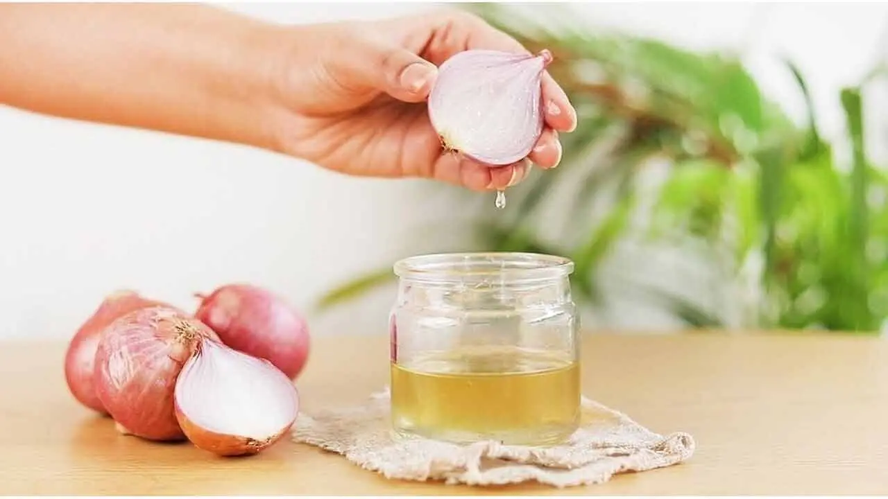 Onion Hair Oil | జుట్టు రాలుతుందా..? ఉల్లిపాయ నూనెతో చెక్ పెట్టండిలా..!