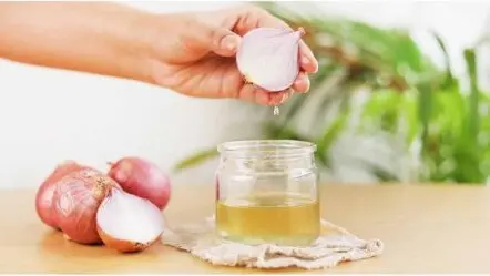 Onion Hair Oil | జుట్టు రాలుతుందా..? ఉల్లిపాయ నూనెతో చెక్ పెట్టండిలా..!