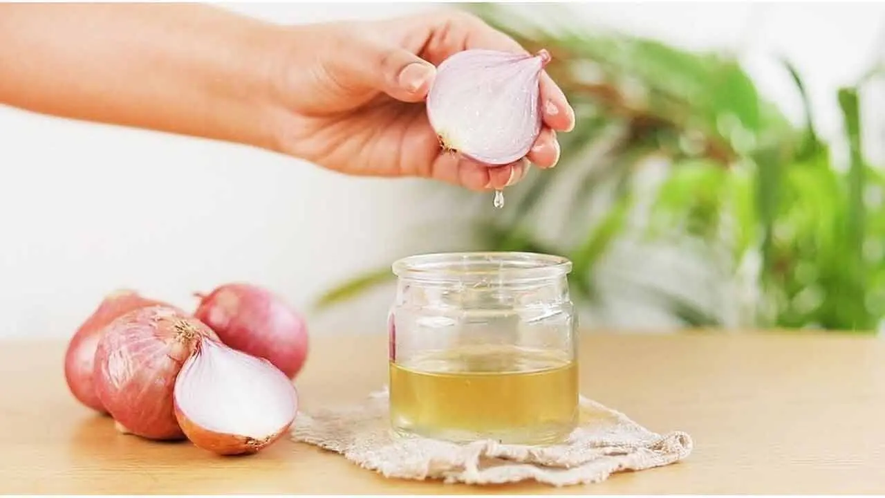 Onion Hair Oil | జుట్టు రాలుతుందా..? ఉల్లిపాయ నూనెతో చెక్ పెట్టండిలా..!